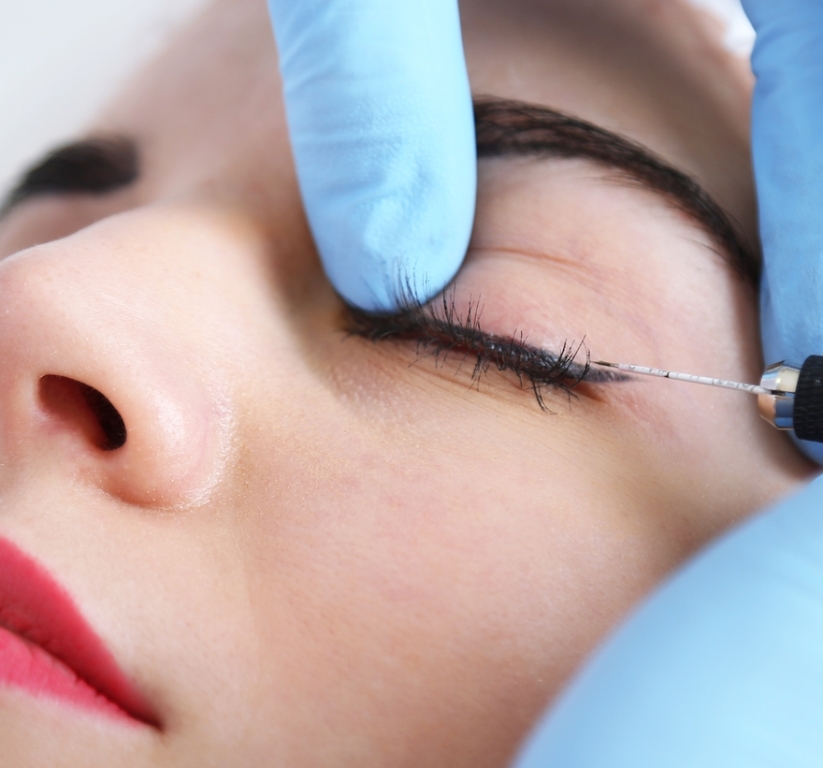 Cejas