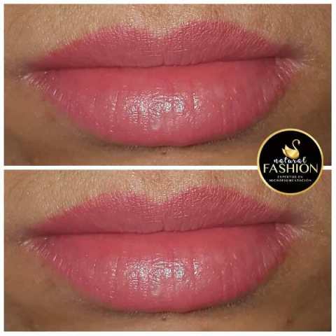 Maquillaje permanente de relleno de labios