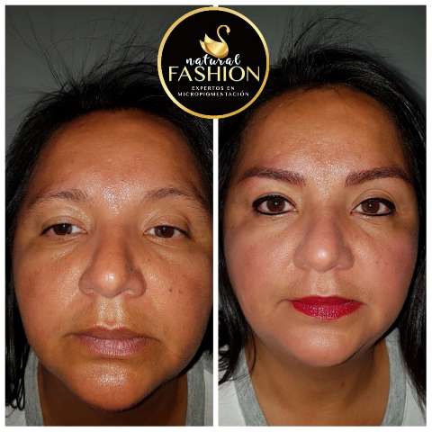 micropigmetnacion de ojos en medellin